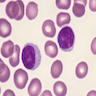 Normal lymphocytes