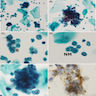 Liquid based cytology