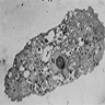 Trophozoite under electron microscope