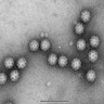 Typical morphology of sapovirus