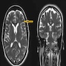 Axial and coronal normal findings