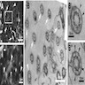 Primary cilia