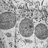 Ciliated cells