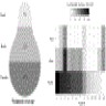 LGD distribution in gallbladder