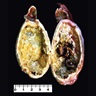 Gallbladder with diffuse transmural calcifications