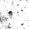 Pleural fluid sediment