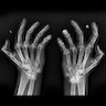 Xray, hands