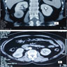 Coronal and axial (contrast) CT scans