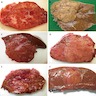 Nodular liver lesions