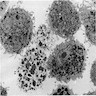 Numerous lysosomes in macrophages