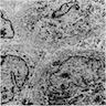 Numerous lysosomes in macrophages