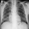 Chest imaging