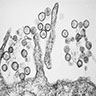 Transmission electron<br>micrograph of<br>Sin Nombre hantavirus