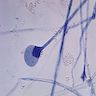 Culture shows young sporangia of Mucor species