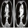 CT before / after targeted therapy