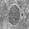 Toxoplasma tissue cyst within an intact neurone