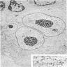 Reed-Sternberg cell nucleus