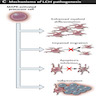 Pathogenesis of Langerhans cell histiocytosis