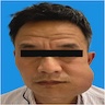 Expansile mandibular mass