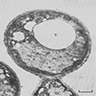 Candida albicans chlamydospore