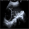 Ultrasound characteristics