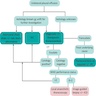 Management of unilateral pleural effusion