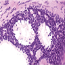 Secretion within cysts