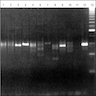 TCR rearrangement via PCR
