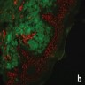 Amorphous pattern with IgM, IgG, IgA, C3
