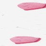 Lichen amyloidosis