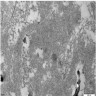 Amyloid fibrils