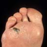 Plantar surface