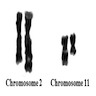 GTG banded karyotype showing 2;11 translocation