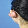 Recurrent keloid formation on earlobe