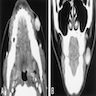 Axial and coronal CT scans of cheek