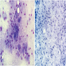 Regular nuclei and granular cytoplasm (Giemsa stain)