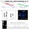 Cytogenetic, FISH and RT-PCR analyses of myolipoma