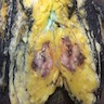 Fleshy, soft, gray-white tumor with necrosis