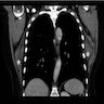 Coronal CT images
