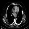 Axial CT images