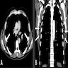 CT scan