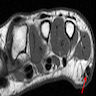 Axial T1 weighted MRI