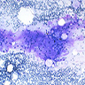 Myxoid stromal with capillaries