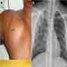 Clinical photograph (a) and chest radiograph (b)