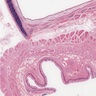 Juxtaposition of smooth and skeletal esophagus