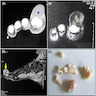 CT and MRI