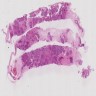 Apocrine ductal carcinoma in situ (H&E)