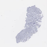 Gastroesophageal junction, H. heilmannii gastritis