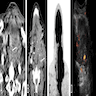 Neck CT, FDG PET scan, sonography