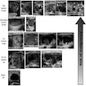 ATA nodule sonographic patterns